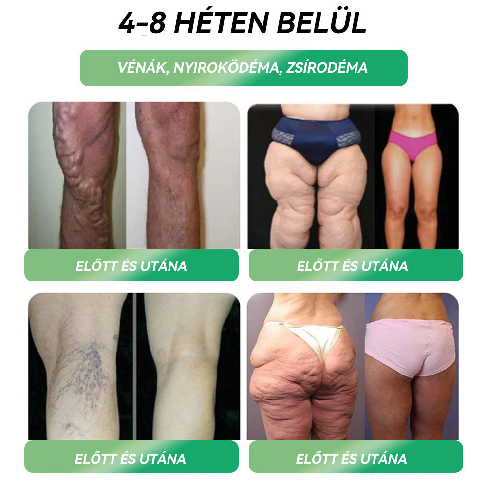 Semmelweis Egyetemi Kórház Ajánlásai |hivatalos áruház |💗💗 𝐒𝐓𝐃𝐄𝐈® 𝐆𝐋𝐏-𝟏 𝐅𝐨𝐠𝐲á)𝐬 𝐒𝐳á𝐣𝐨𝐧 á𝐭 𝐚𝐥𝐤𝐚𝐥𝐦𝐚𝐳𝐡𝐚𝐭ó 𝐨𝐥𝐝𝐚𝐭 - 👨⚕️ Elhízás, szív- és érrendszeri betegségek, cukorbetegség, alvási apnoe, ízületi problémák és egyebek