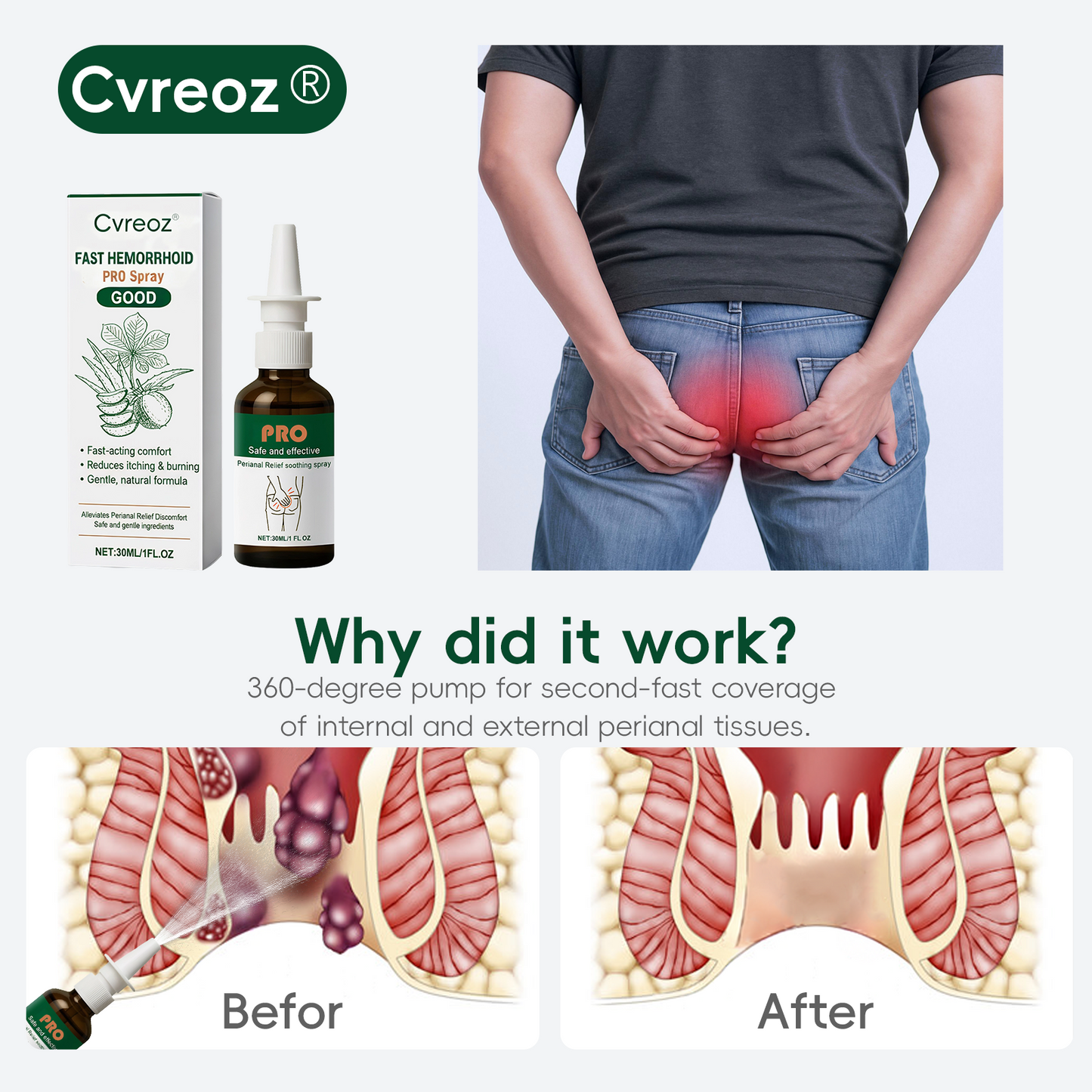 🔥 Karácsonyi Vásári Akció | Cvreoz® Fast Hemorrhoid PRO Spray