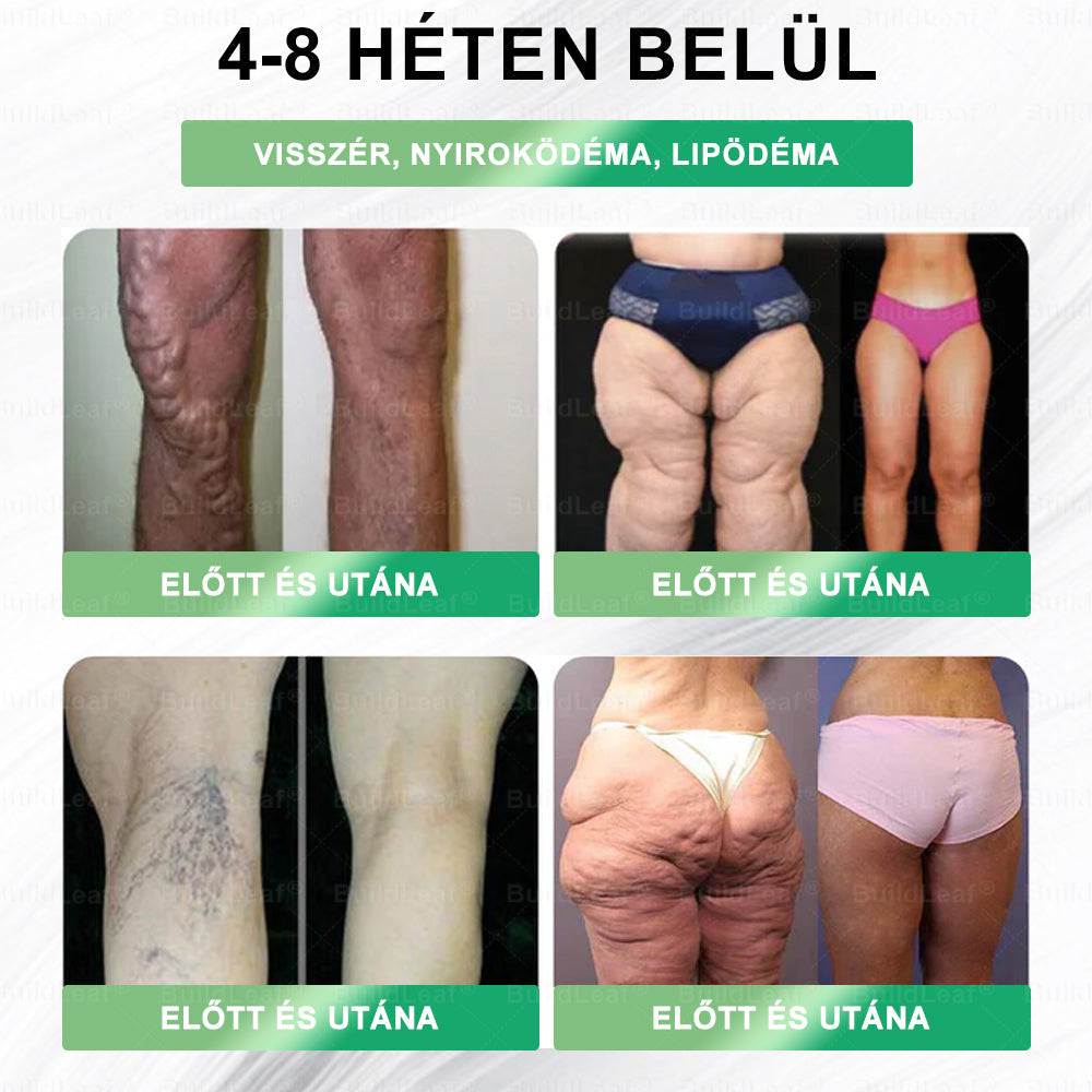 👍𝑩𝒖𝒊𝒍𝒅𝑳𝒆𝒂𝒇® 𝑮𝑳𝑷-1 8-𝒊𝒏-1 𝑭𝒊𝒕 & 𝑽𝒊𝒕𝒂𝒍 𝑺𝒛á𝒋𝒉𝒊𝒈𝒊é𝒏𝒊𝒂𝒊 𝑶𝒍𝒅𝒂𝒕 👍 𝑨𝒍𝒌𝒂𝒍𝒎𝒂𝒔 𝒆𝒍𝒉í𝒛á𝒔, 𝒔𝒛í𝒗- é𝒔 é𝒓𝒓𝒆𝒏𝒅𝒔𝒛𝒆𝒓𝒊 𝒆𝒈é𝒔𝒛𝒔é𝒈, 𝒄𝒖𝒌𝒐𝒓𝒃𝒆𝒕𝒆𝒈𝒔é𝒈, 𝒂𝒍𝒗á𝒔𝒊 𝒂𝒑𝒏𝒐𝒆, 𝒃é𝒍𝒓𝒆𝒏𝒅𝒔𝒛𝒆𝒓𝒊 𝒆𝒈é𝒔𝒛𝒔é𝒈, í𝒛ü𝒍𝒆𝒕𝒊 𝒑𝒓𝒐𝒃𝒍é𝒎á𝒌 é𝒔 𝒆𝒈𝒚é𝒃 𝒆𝒈é𝒔𝒛𝒔é𝒈ü𝒈𝒚𝒊 𝒊𝒈é𝒏𝒚𝒆𝒌 𝒆𝒔𝒆𝒕é𝒏
