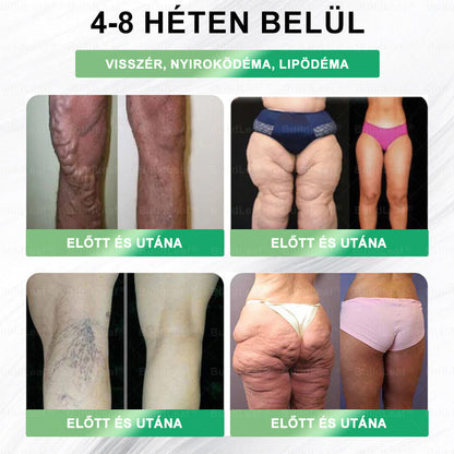 👍𝑩𝒖𝒊𝒍𝒅𝑳𝒆𝒂𝒇® 𝑮𝑳𝑷-1 8-𝒊𝒏-1 𝑭𝒊𝒕 & 𝑽𝒊𝒕𝒂𝒍 𝑺𝒛á𝒋𝒉𝒊𝒈𝒊é𝒏𝒊𝒂𝒊 𝑶𝒍𝒅𝒂𝒕 👍 𝑨𝒍𝒌𝒂𝒍𝒎𝒂𝒔 𝒆𝒍𝒉í𝒛á𝒔, 𝒔𝒛í𝒗- é𝒔 é𝒓𝒓𝒆𝒏𝒅𝒔𝒛𝒆𝒓𝒊 𝒆𝒈é𝒔𝒛𝒔é𝒈, 𝒄𝒖𝒌𝒐𝒓𝒃𝒆𝒕𝒆𝒈𝒔é𝒈, 𝒂𝒍𝒗á𝒔𝒊 𝒂𝒑𝒏𝒐𝒆, 𝒃é𝒍𝒓𝒆𝒏𝒅𝒔𝒛𝒆𝒓𝒊 𝒆𝒈é𝒔𝒛𝒔é𝒈, í𝒛ü𝒍𝒆𝒕𝒊 𝒑𝒓𝒐𝒃𝒍é𝒎á𝒌 é𝒔 𝒆𝒈𝒚é𝒃 𝒆𝒈é𝒔𝒛𝒔é𝒈ü𝒈𝒚𝒊 𝒊𝒈é𝒏𝒚𝒆𝒌 𝒆𝒔𝒆𝒕é𝒏